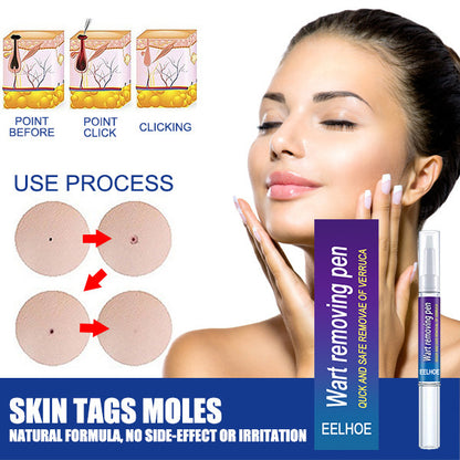 Wart Remover Pen  - Fast & Gentle Solution